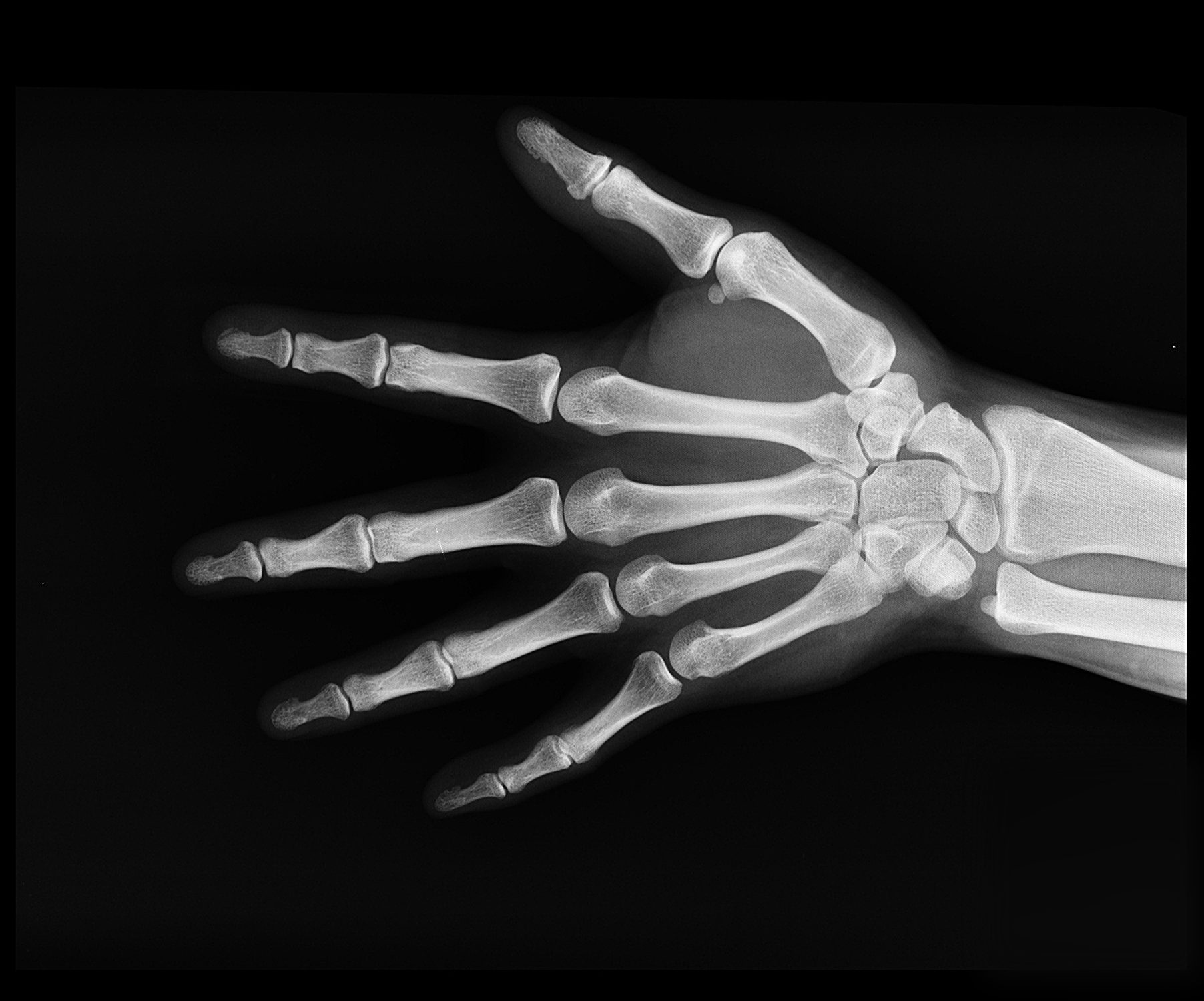 Facts You May Not Have Known About X-Rays - Seton Imaging